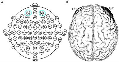 Modulating OFC Activity With tDCS Alters Regret About Human Decision-Making